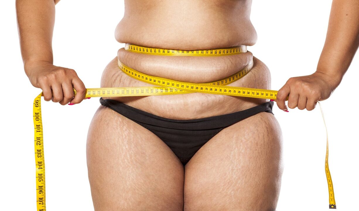 Excess weight and weight loss using Keto Probiox